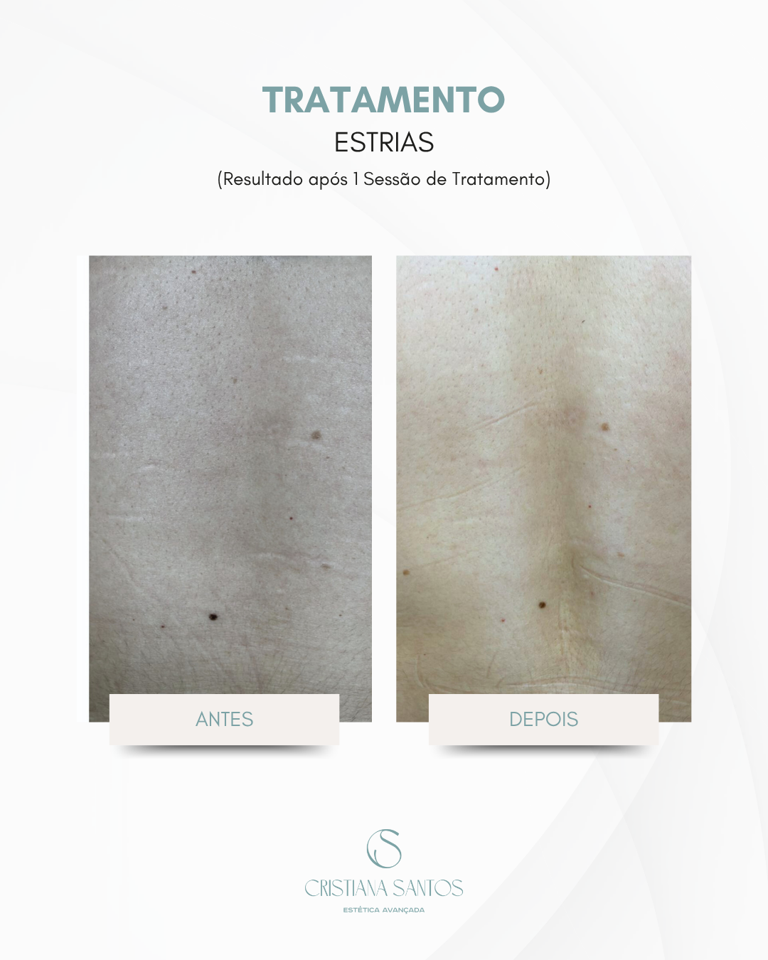 EnfªCS_ Casos Clínicos (5)